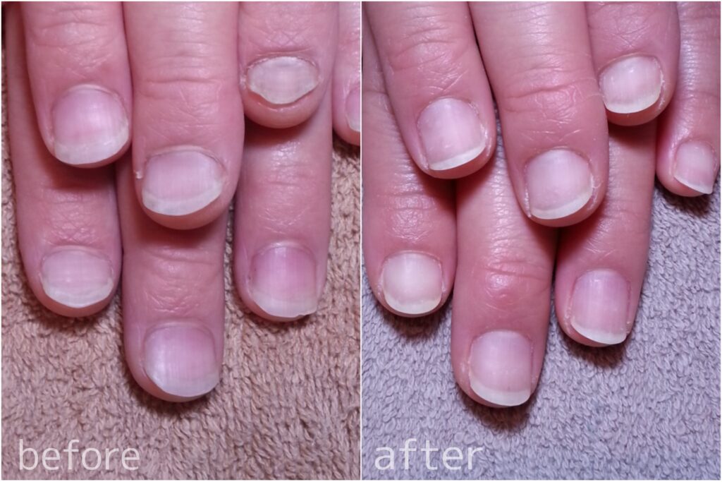 手や爪にお悩みの方へ Serje Nail 手や爪にお悩みの方へ Serje Nail